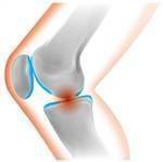 膝の痛みを予防する